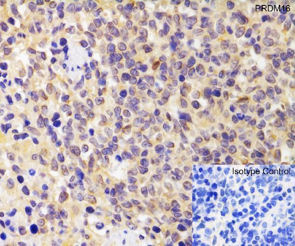 a00782 prdm16 primary antibodies ihc testing 7