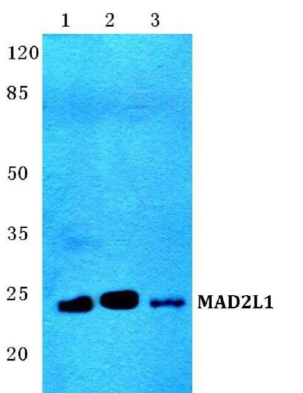 Western blot (WB) analysis of MAD2L1 polyclonal antibody at 1:500 dilution
Lane1:MCF-7 cell lysate
Lane2:sp2/0 cell lysate
Lane3:Rat kidney tissue lysate