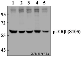 a00786s105 esr2 primary antiboties wb testing 1