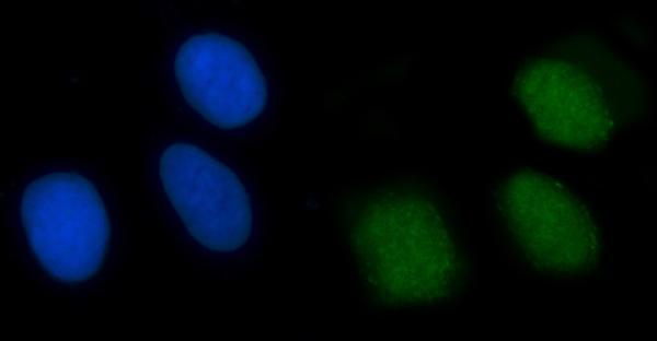 a00787 2 xrcc4 primary antibodies if testing 8