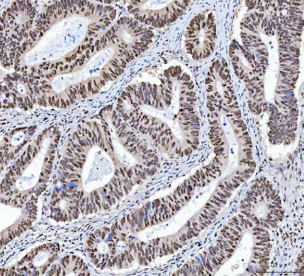 a00787 2 xrcc4 primary antibodies ihc testing 4