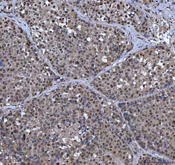 a00787 2 xrcc4 primary antibodies ihc testing 5