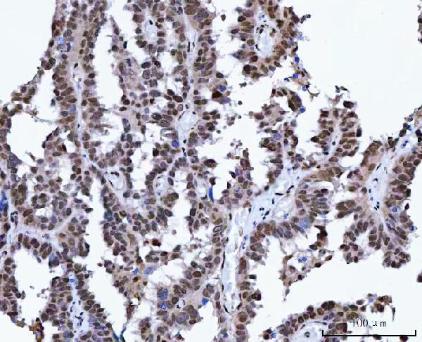 a00787 2 xrcc4 primary antibodies ihc testing 6