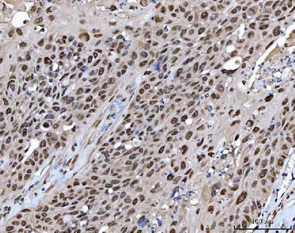 a00787 2 xrcc4 primary antibodies ihc testing 7