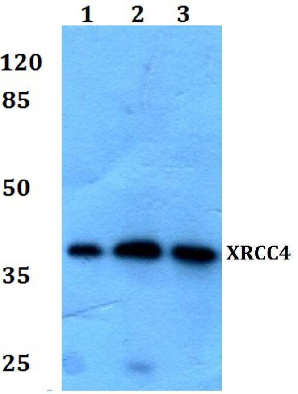 Western blot (WB) analysis of XRCC4 polyclonal antibody at 1:500 dilution
Lane1:MCF-7 whole cell lysate
Lane2:HEK293T whole cell lysate
Lane3:NIH-3T3 whole cell lysate
