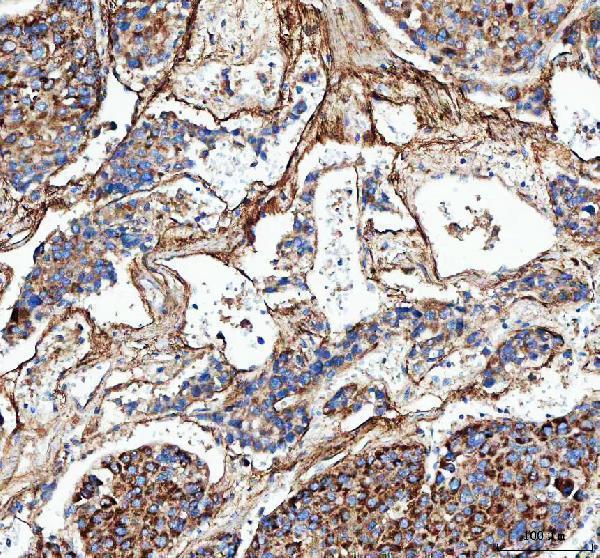 a00788 3 col3a1 primary antibodies ihc testing 4