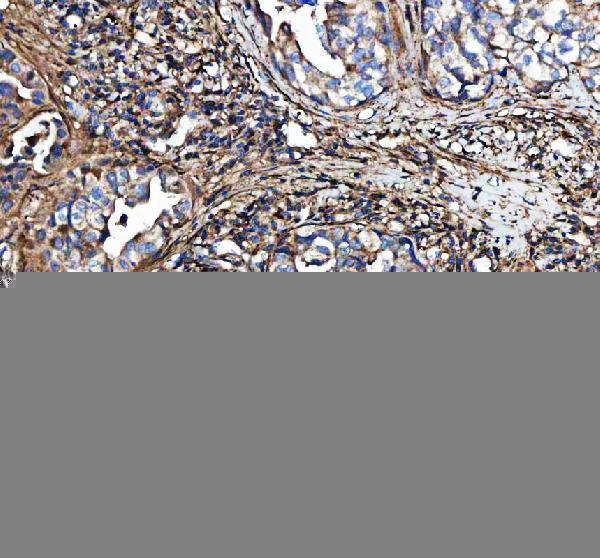 a00788 3 col3a1 primary antibodies ihc testing 5