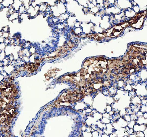 a00788 3 col3a1 primary antibodies ihc testing 6
