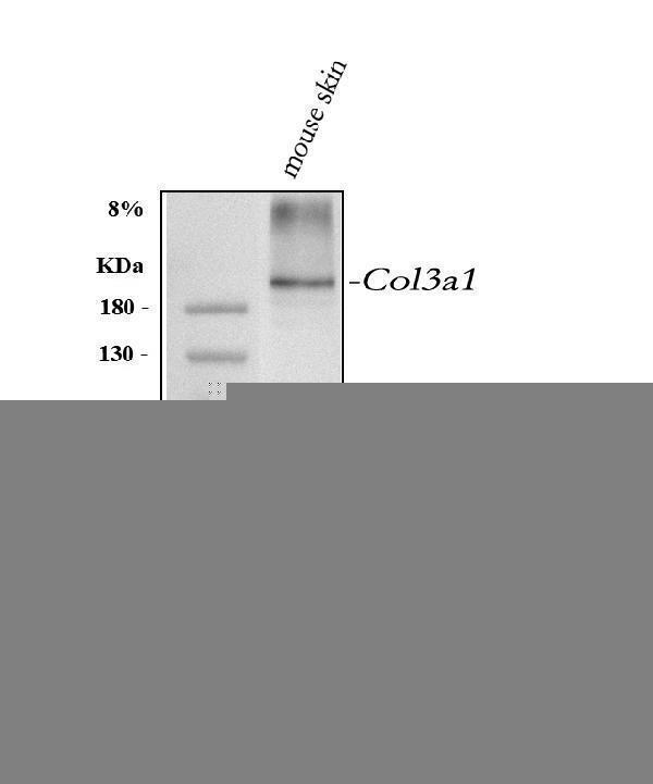 a00788 3 col3a1 primary antibodies wb testing 1