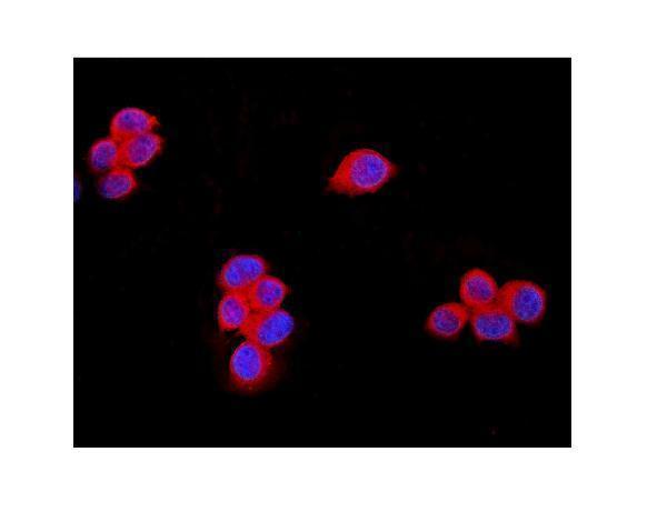 a00789 1 trpm7 primary antibodies if testing 2