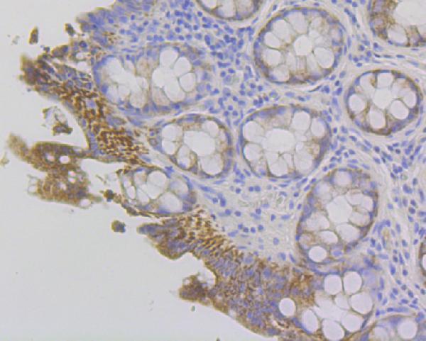 a00790 fgg primary antiboties ihc testing 2