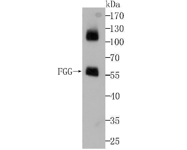a00790 fgg primary antiboties wb testing 1