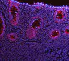 a00791 3 gsk3b primary antibodies if testing 2_1