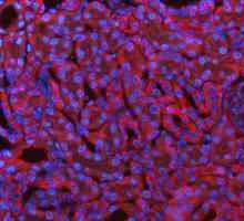 a00791 3 gsk3b primary antibodies if testing 4_1