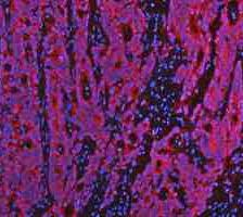 a00791 3 gsk3b primary antibodies if testing 5_1