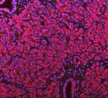 a00791 3 gsk3b primary antibodies if testing 7_1