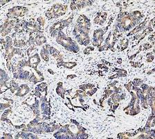 a00791 3 gsk3b primary antibodies ihc testing 10