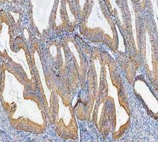 a00791 3 gsk3b primary antibodies ihc testing 11