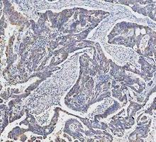 a00791 3 gsk3b primary antibodies ihc testing 12