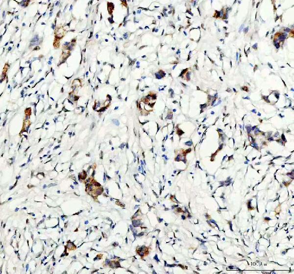  IHC analysis of GSK3 beta/GSK3B using anti-GSK3 beta/GSK3B antibody (A00791-3)