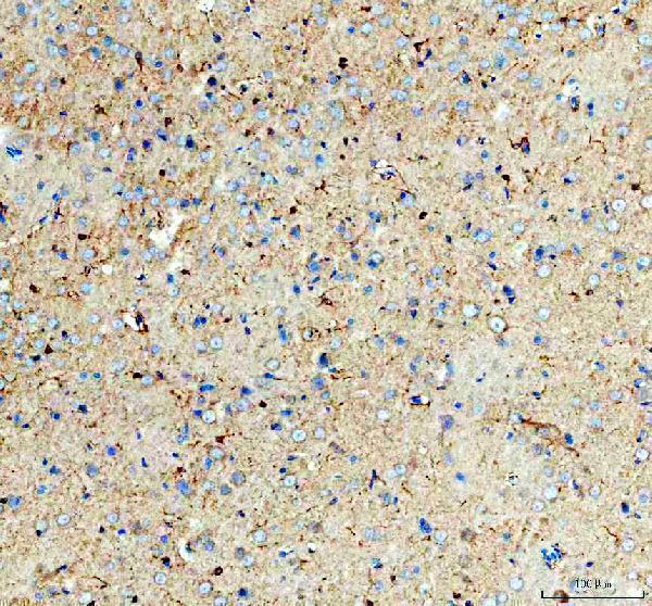a00791 3 gsk3b primary antibodies ihc testing 7