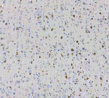 a00791 3 gsk3b primary antibodies ihc testing 7