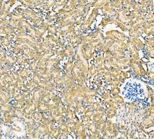 a00791 3 gsk3b primary antibodies ihc testing 8
