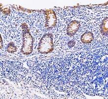 a00791 3 gsk3b primary antibodies ihc testing 9