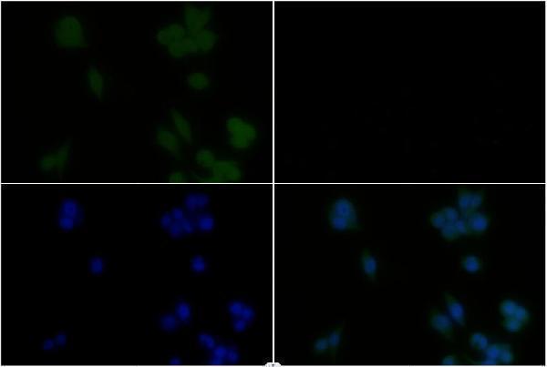 Immunofluorescence analysis of MCF-7 cells using GSK3β (S13) pAb at dilution of 1:200 (40x lens)