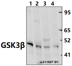 Western blot (WB) analysis of GSK3β (S13) polyclonal antibody at 1:1000 dilution
Lane1:The Spleen tissue lysate of Mouse(40ug)
Lane2:The Brain tissue lysate of Rat(40ug)
Lane3:U-87MG whole cell lysate(40ug)
Lane4:A549 whole cell lysate(40ug)