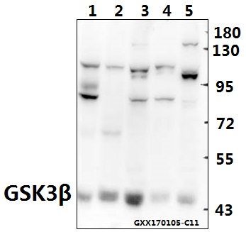 Western blot (WB) analysis of GSK3β (S2) polyclonal antibody at 1:500 dilution
Lane1:H9C2 whole cell lysate(40ug)
Lane2:CT26 whole cell lysate(40ug)
Lane3:COS-7 whole cell lysate(40ug)
Lane4:L02 whole cell lysate(40ug)
Lane5:HEK293T whole cell lysate(40ug)