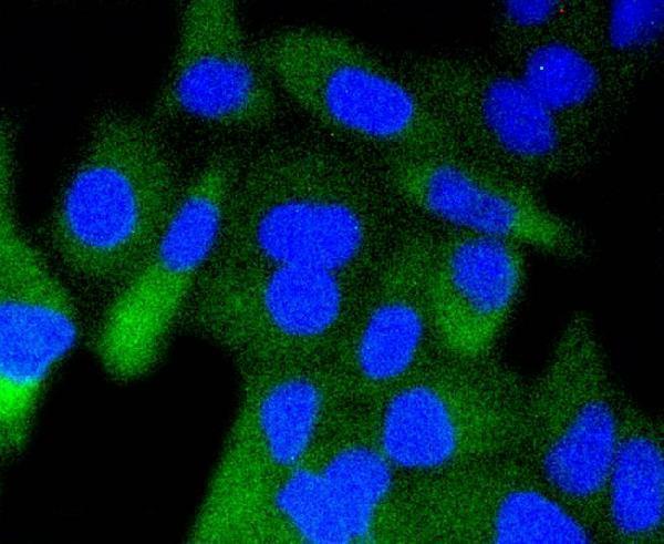 ICC staining Phospho-GSK3 beta(Ser 9) in Hela cells (green)