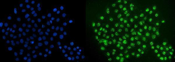  IF analysis of ERG using anti-ERG antibody (A00793-1)