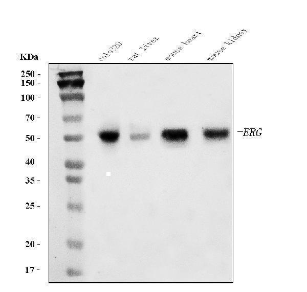  Western blot analysis of ERG using anti-ERG antibody (A00793-1)