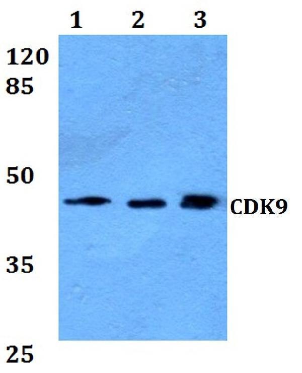 a00794 1 cdk9 primary antiboties wb testing 1