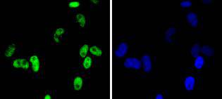 a00794 2 cdk9 primary antiboties icc testing 2