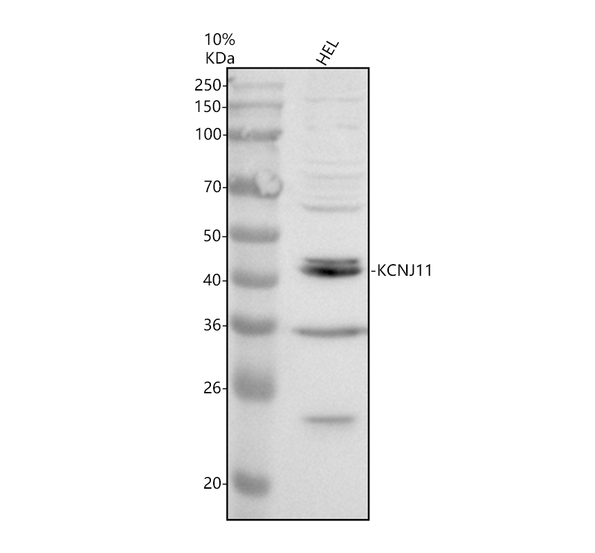 a00795 1 kcnj11 primary antibodies wb testing 1