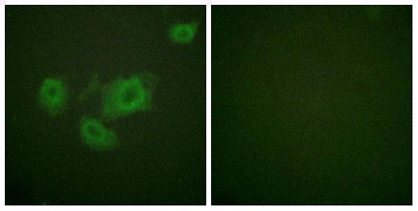Immunofluorescence analysis of HUVEC cells, using Kir6