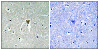 Immunohistochemical analysis of paraffin-embedded Human brain