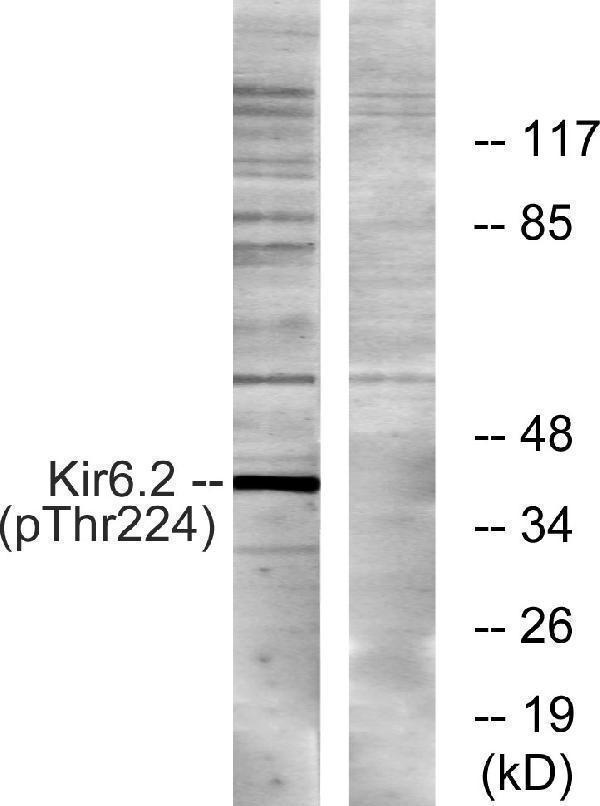 Western blot analysis of lysates from HeLa cells, using Kir6