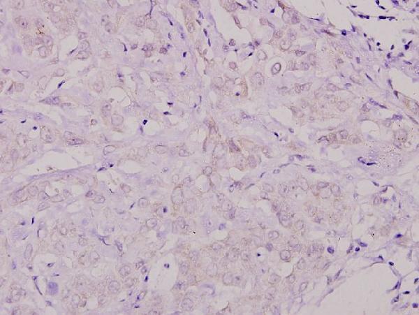 a00796 shc1 primary antiboties ihc testing 2