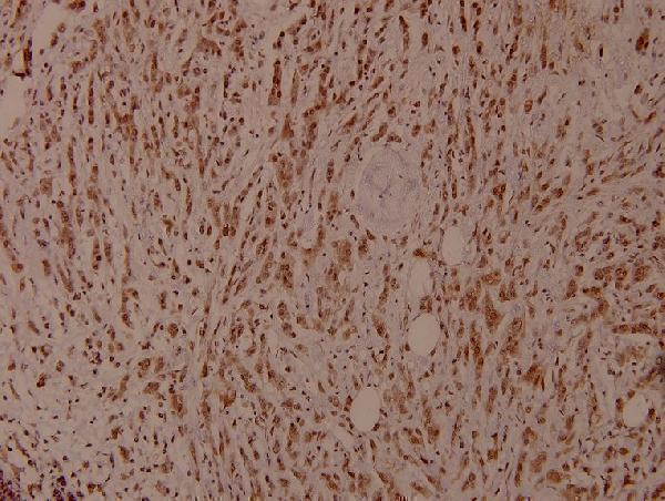 a00796y349 shc1 primary antiboties ihc testing 2