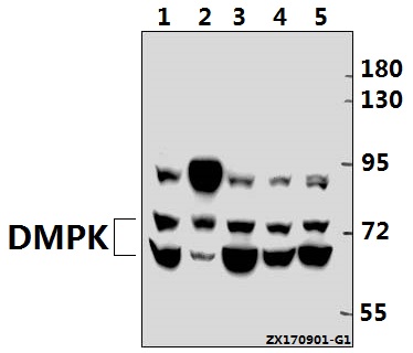Western blot (WB) analysis of DMPK (R30) pAb at 1:500 dilution
Lane1:CT26 whole cell lysate(40ug)
Lane2:The Brain tissue lysate of Rat(40ug)
Lane3:A549 whole cell lysate(40ug)
Lane4:L02 whole cell lysate(40ug)
Lane5:HEK293T whole cell lysate(20ug)