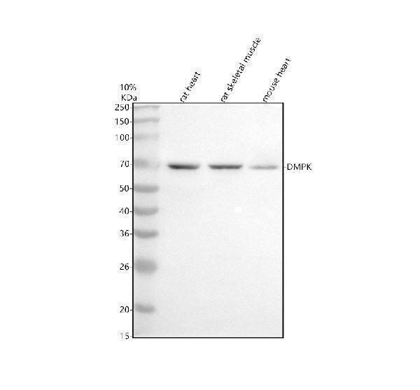  Western blot analysis of DMPK using anti-DMPK antibody (A00797-2)