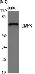 Western Blot analysis of various cells using DMPK Polyclonal Antibody