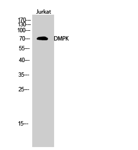 Western Blot analysis of Jurkat cells using DMPK Polyclonal Antibody
