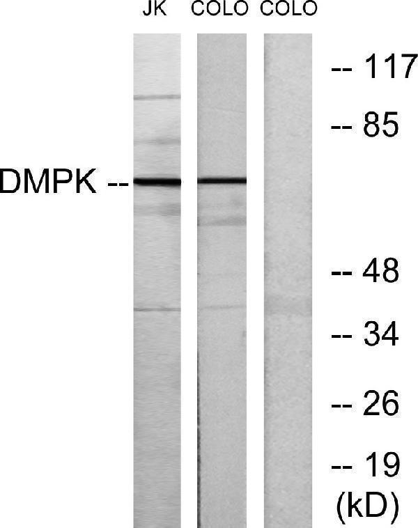 Western blot analysis of lysates from Jurkat and COLO205 cells, using DMPK Antibody