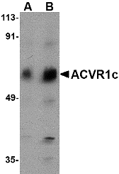 Western blot analysis of ACVR1C in human placenta tissue lysate with ACVR1C antibody at (A) 1 and (B) 2 μg/mL