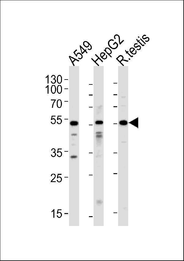 Western blot analysis of lysates from A549,HepG2 cell line and rat testis tissue (from left to right),using ACVR1 Antibody (N-term)