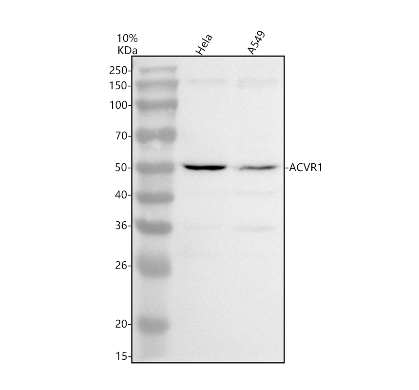 Western blot analysis of ACVR1 using anti-ACVR1 antibody (A00798-4)